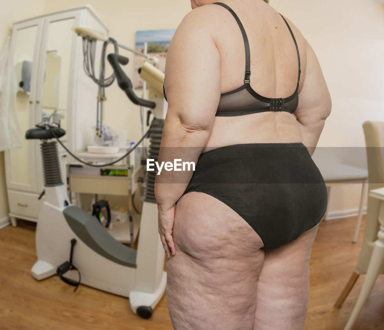 Woman with obesity and cellulite in a treatment room with a doctor