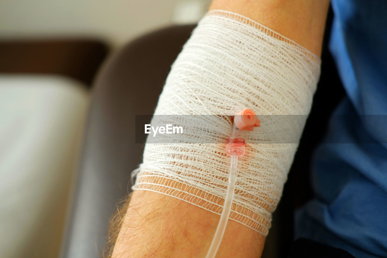 physical injury, healthcare and medicine, medical supplies, recovery, bandage, patient, fracture, pain, close-up, limb, hospital, human limb, arm, medical, misfortune, indoors, hand, human leg, wound, adult, blood, finger, illness, one person, surgery, skin, broken, adhesive bandage, care