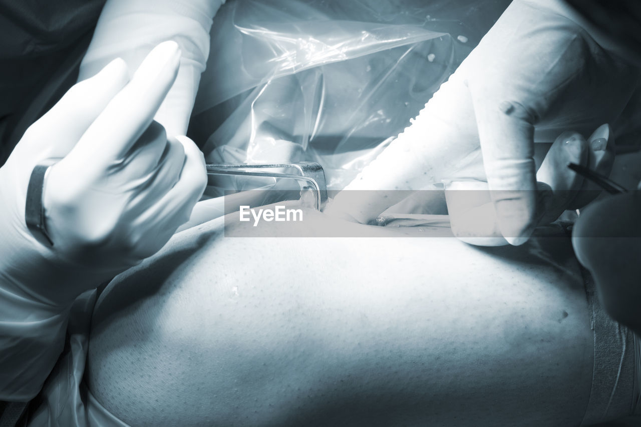 Cropped hands of surgeon performing surgery on patient