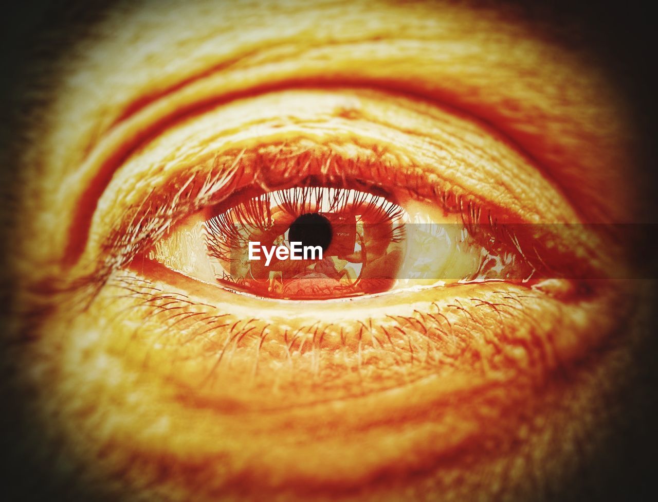 CLOSE-UP OF EYE