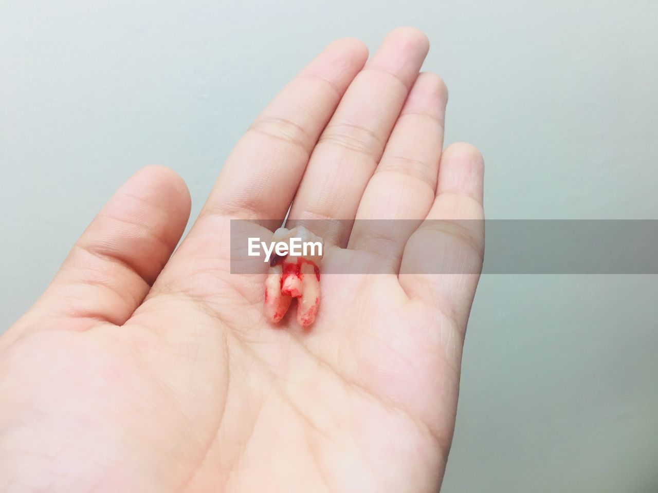 Cropped hand of person holding broken tooth