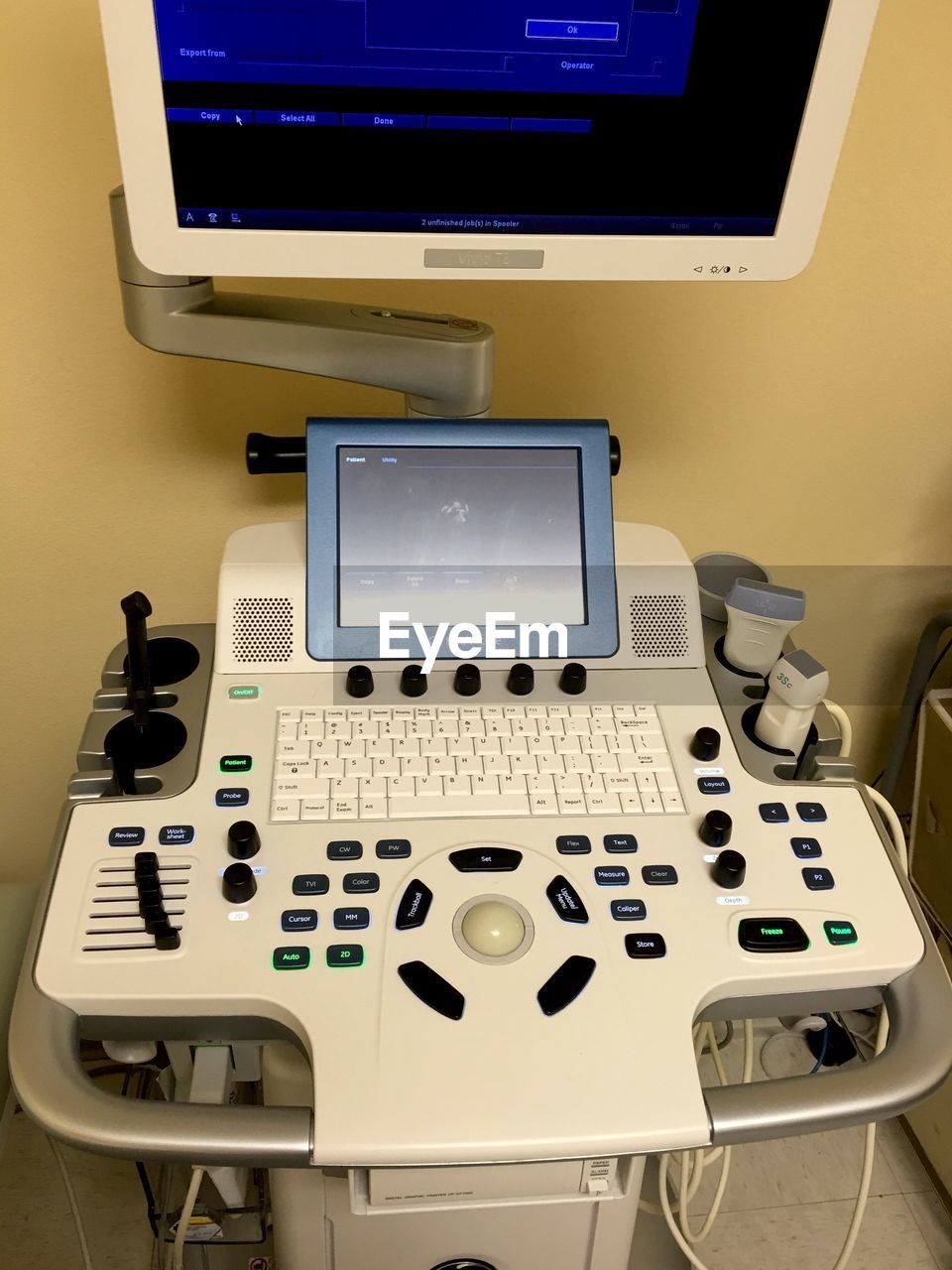 Ultrasound equipment at doctor office