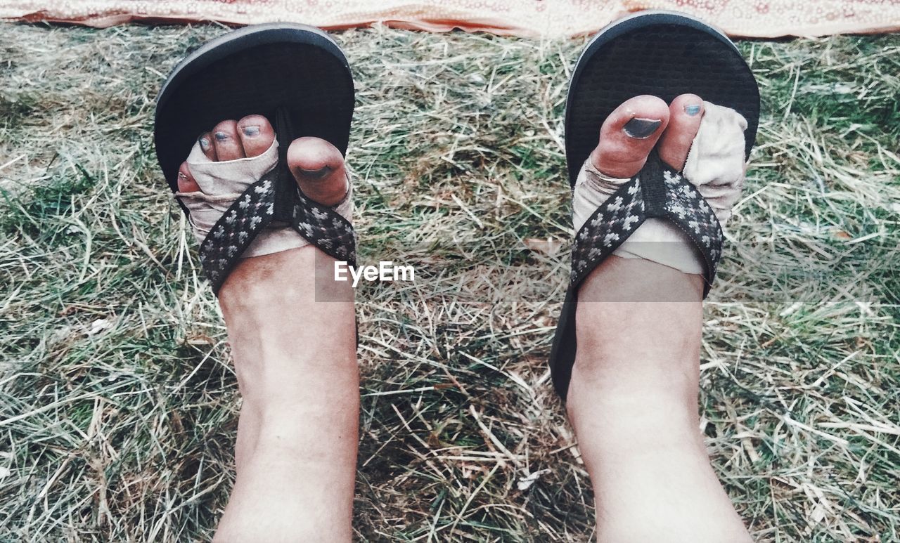 Low section of injured woman wearing flip-flops on grassy field