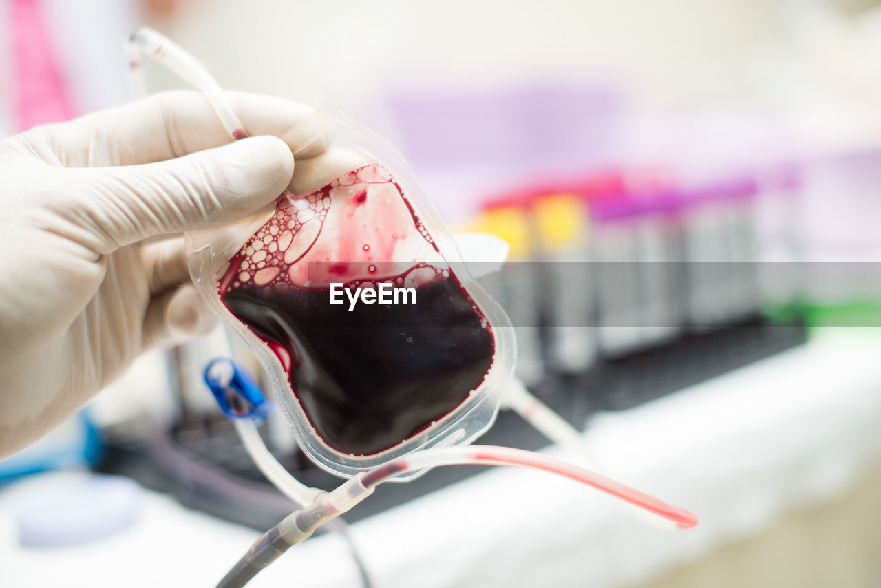 Cropped hand of doctor holding blood bag