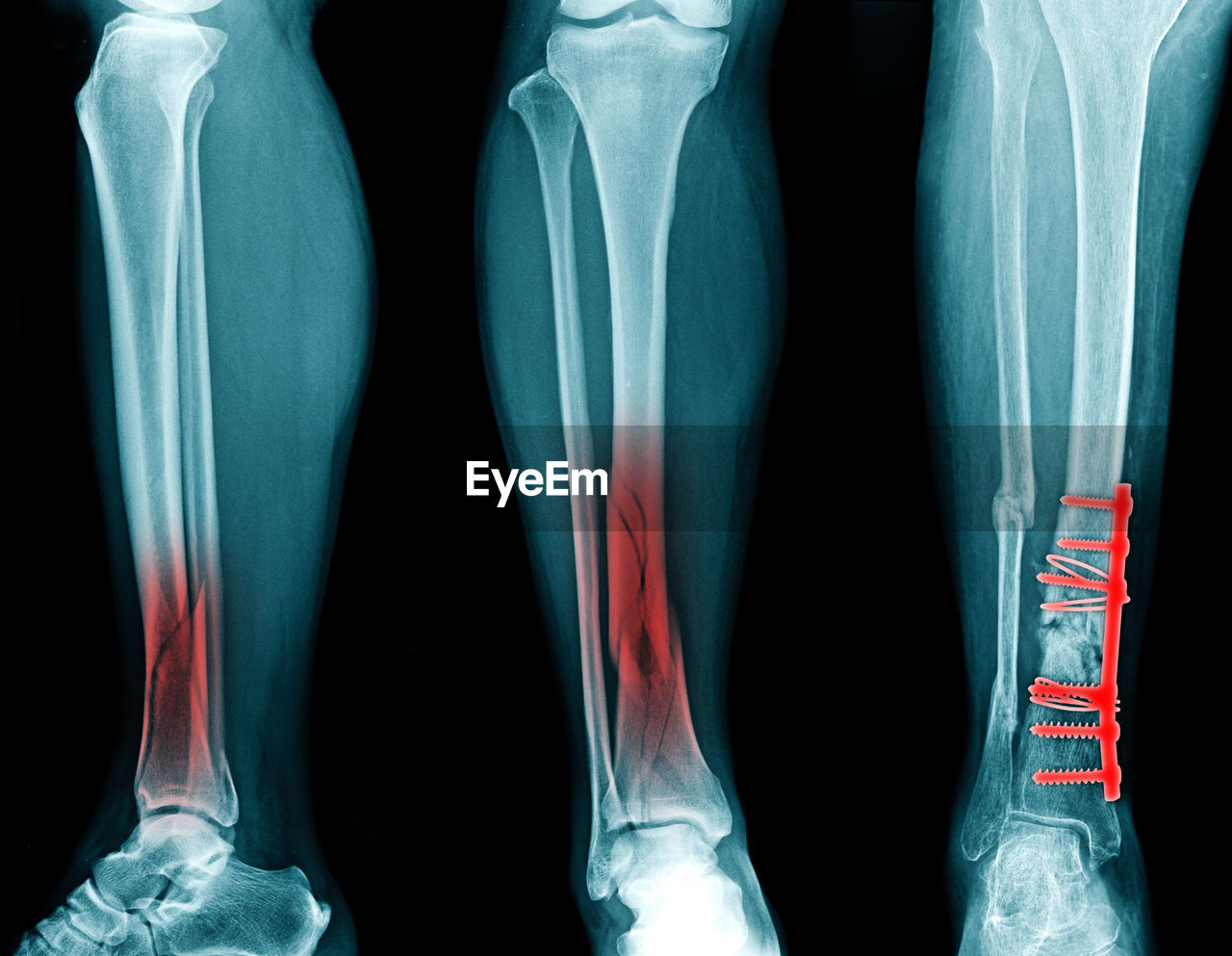 Full frame shot of x-ray