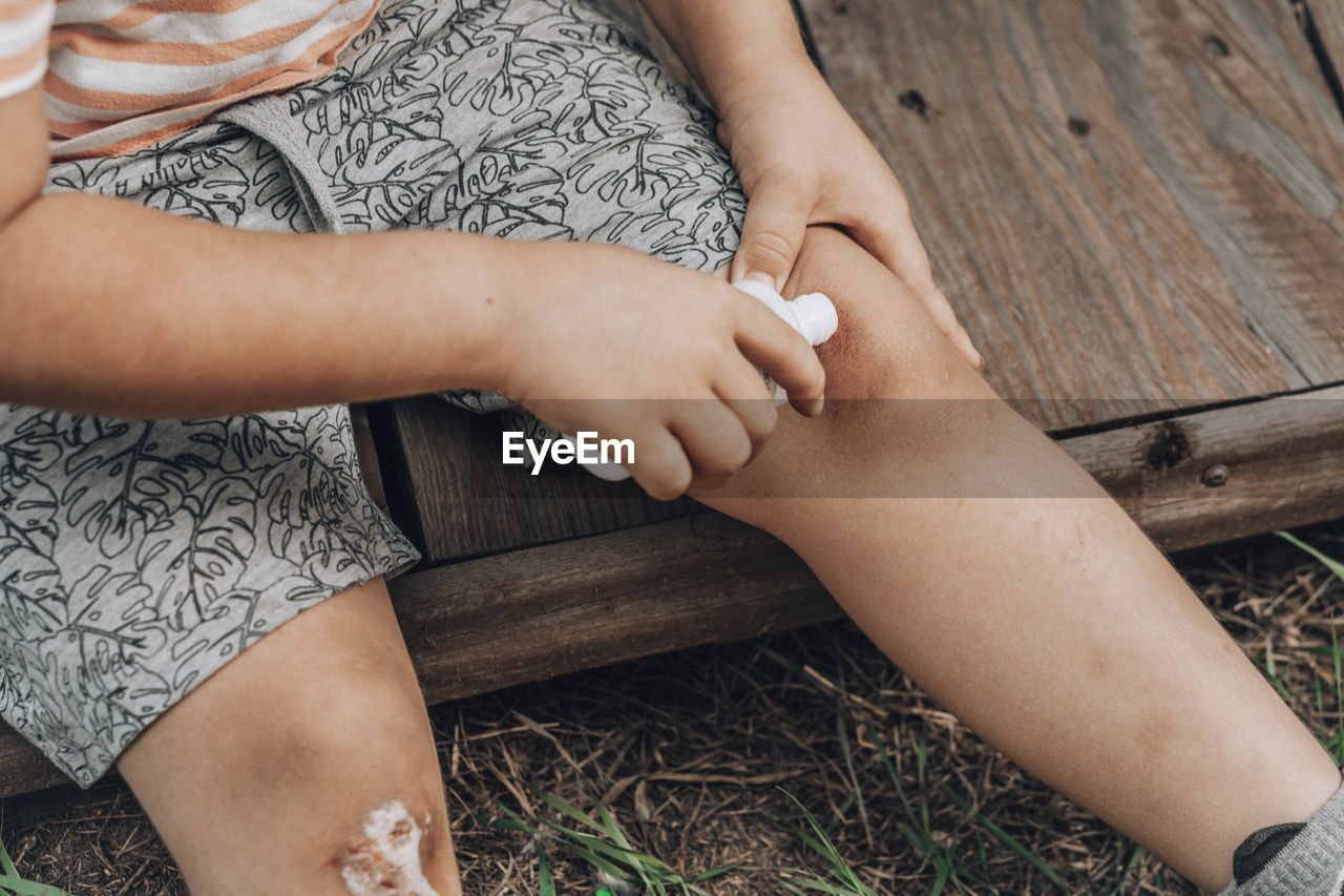 Child's leg injury. injured knee, fell off close up. boy uses antibacterial agent to treat the wound