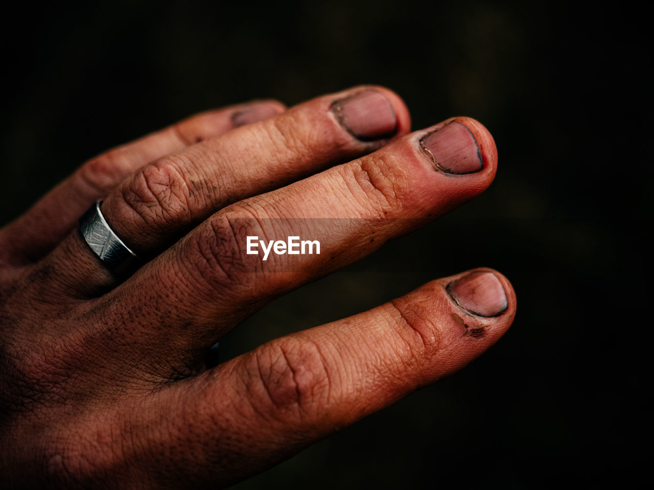 Cropped image of dirty hand on black background