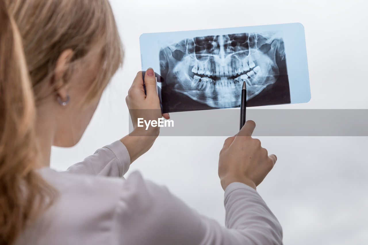 Rear view of woman holding medical x-ray against white background