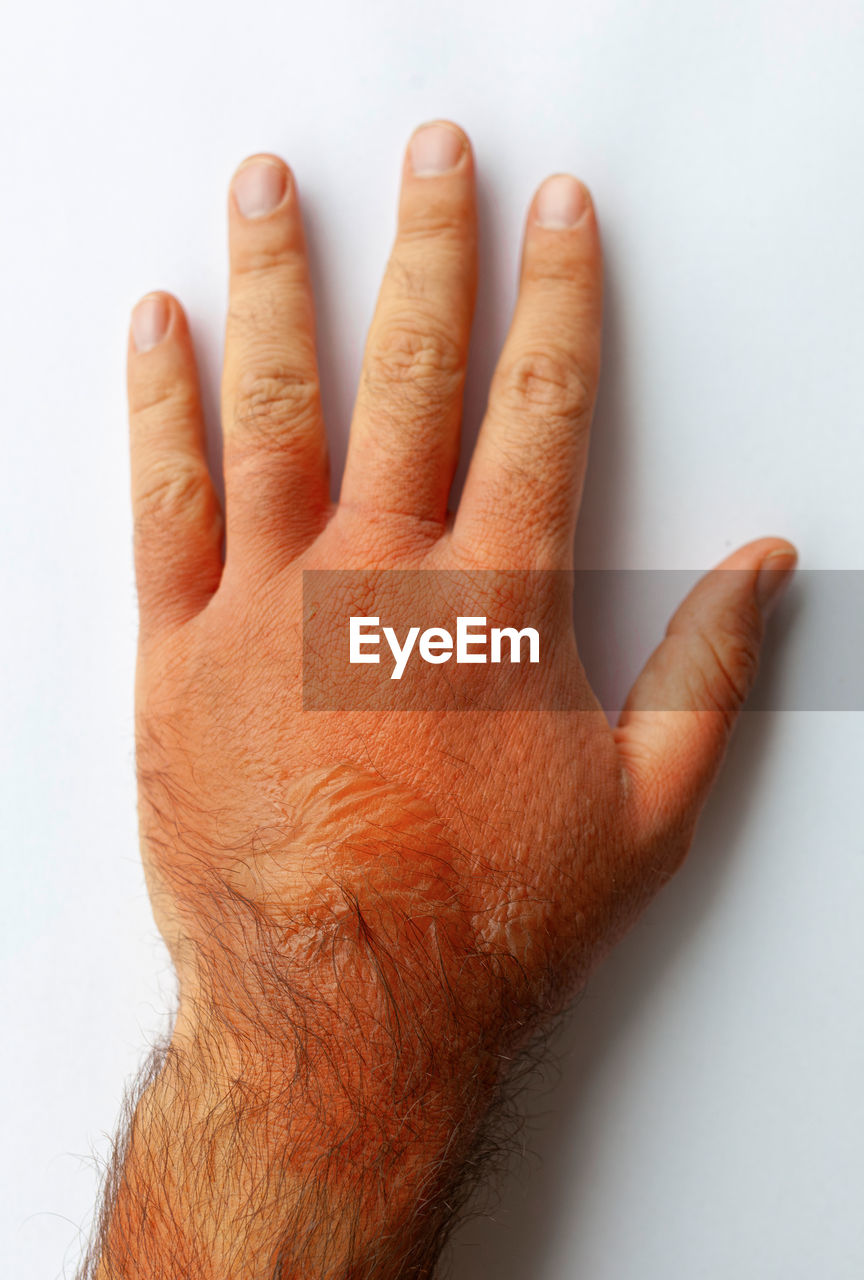 hand, finger, arm, one person, studio shot, close-up, indoors, white background, human skin, adult, skin, limb, nail