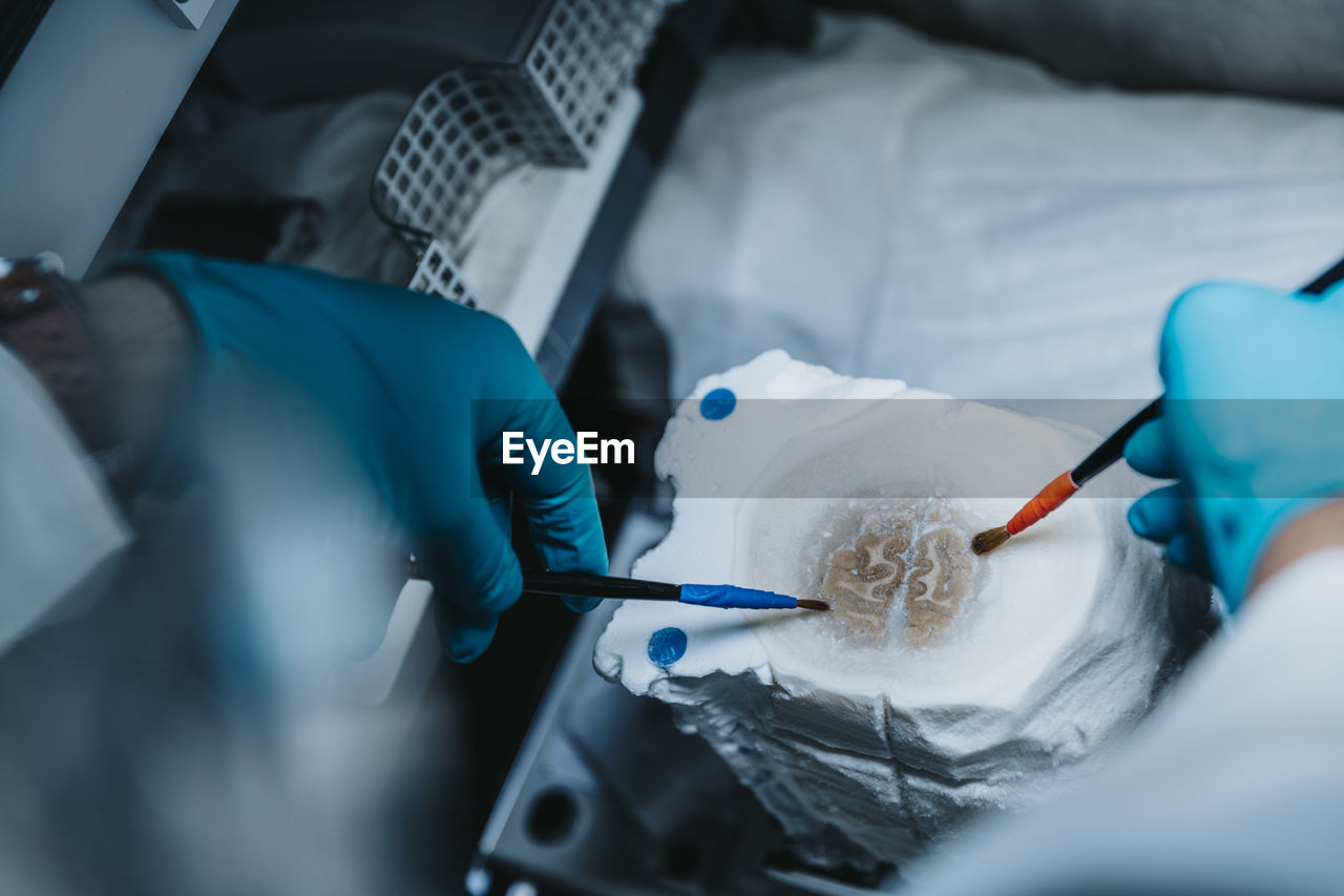 Scientist preparing slice of human brain while standing by freezer at laboratory