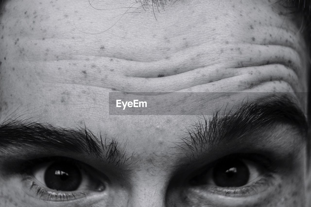 Cropped portrait of man with freckles on forehead