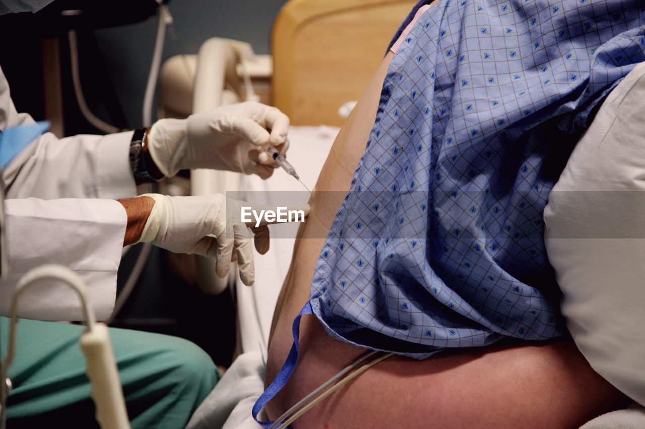 Woman receiving epidural anesthesia