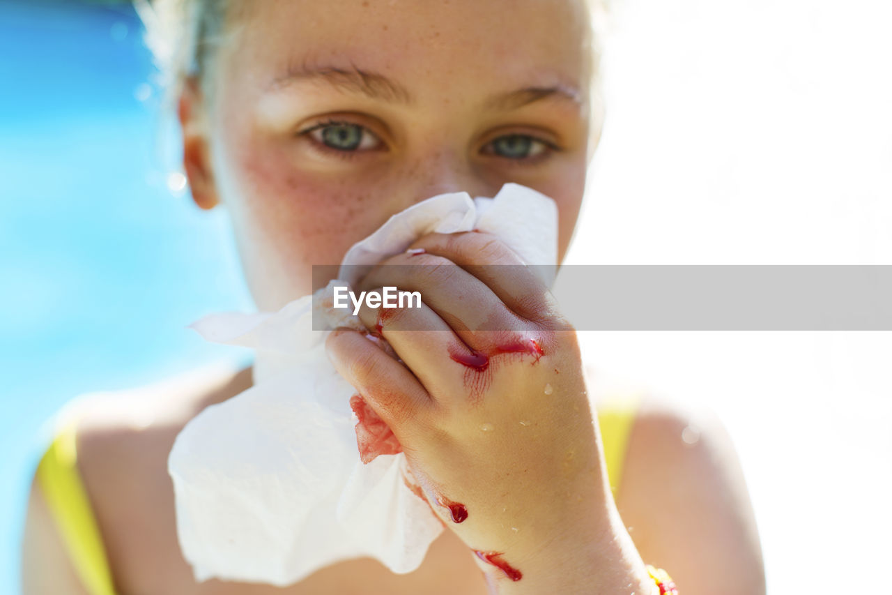 Portrait of girl covering her bleeding nose