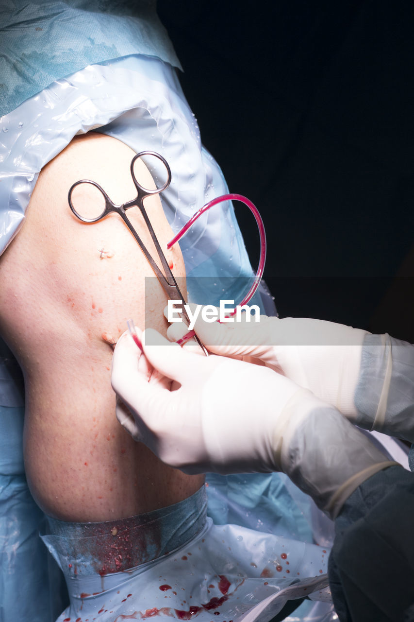 Cropped hands of surgeon doing knee surgery in hospital