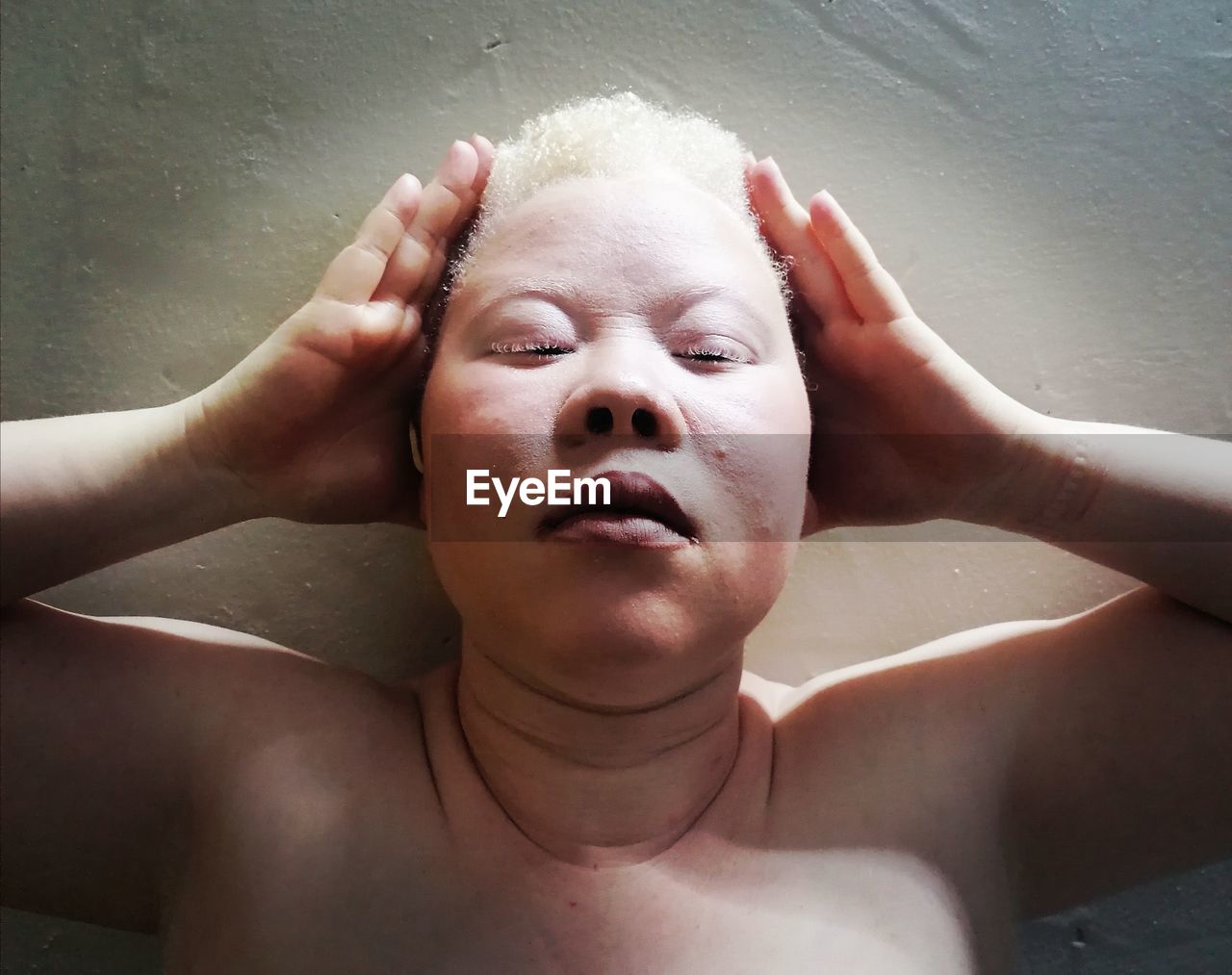 Body and face of an albinistic woman 