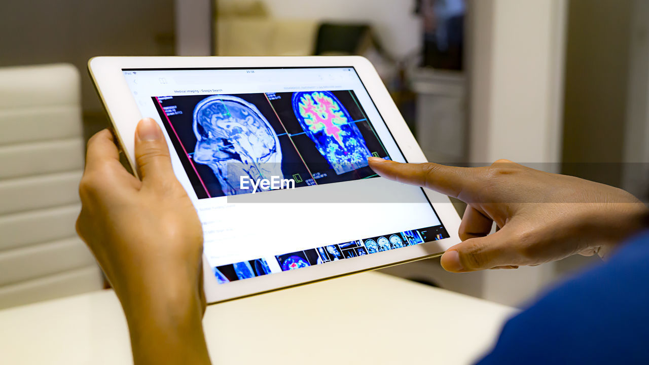 Cropped hands of doctor holding digital tablet with x-ray on table