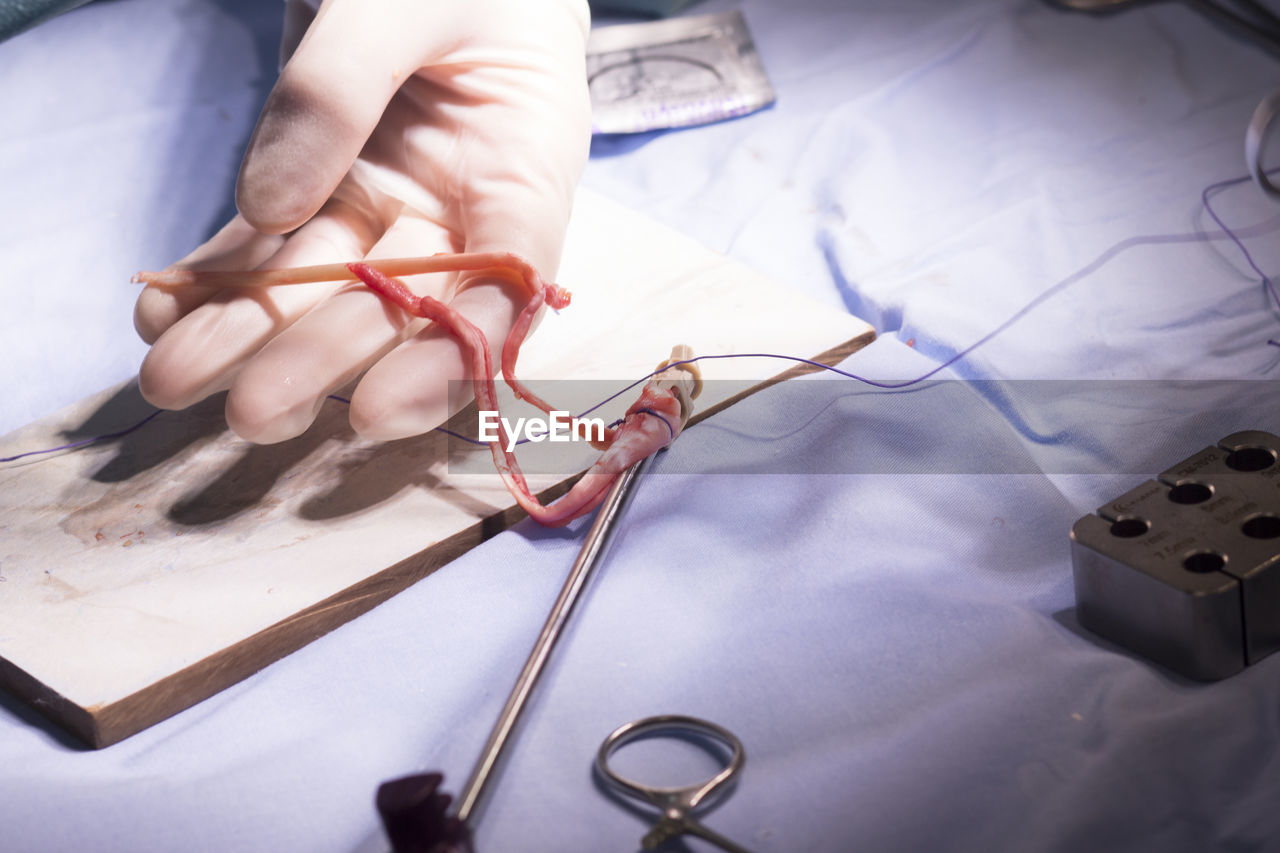 Cropped hand of doctor stitching human body part