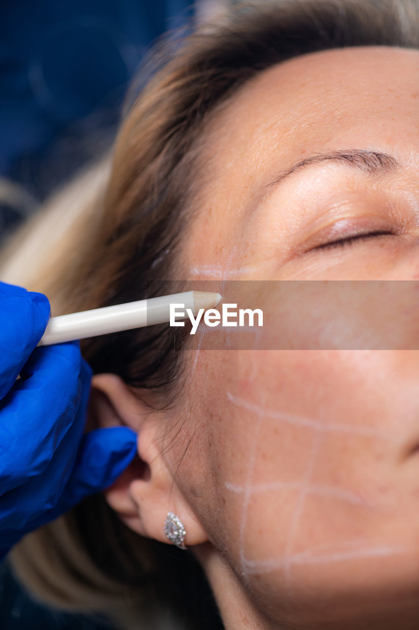 Cropped hand of person drawing on face during botox