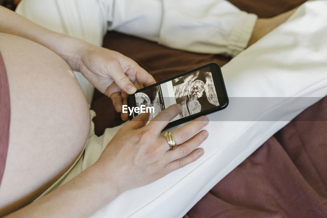 Pregnant woman examining medical x-ray photographs on smart phone