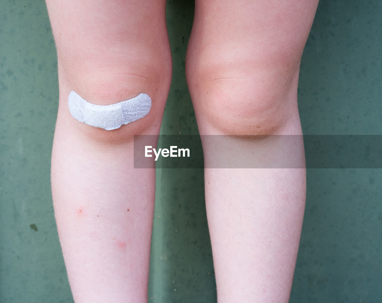 Midsection of girl knee with adhesive bandage against wall