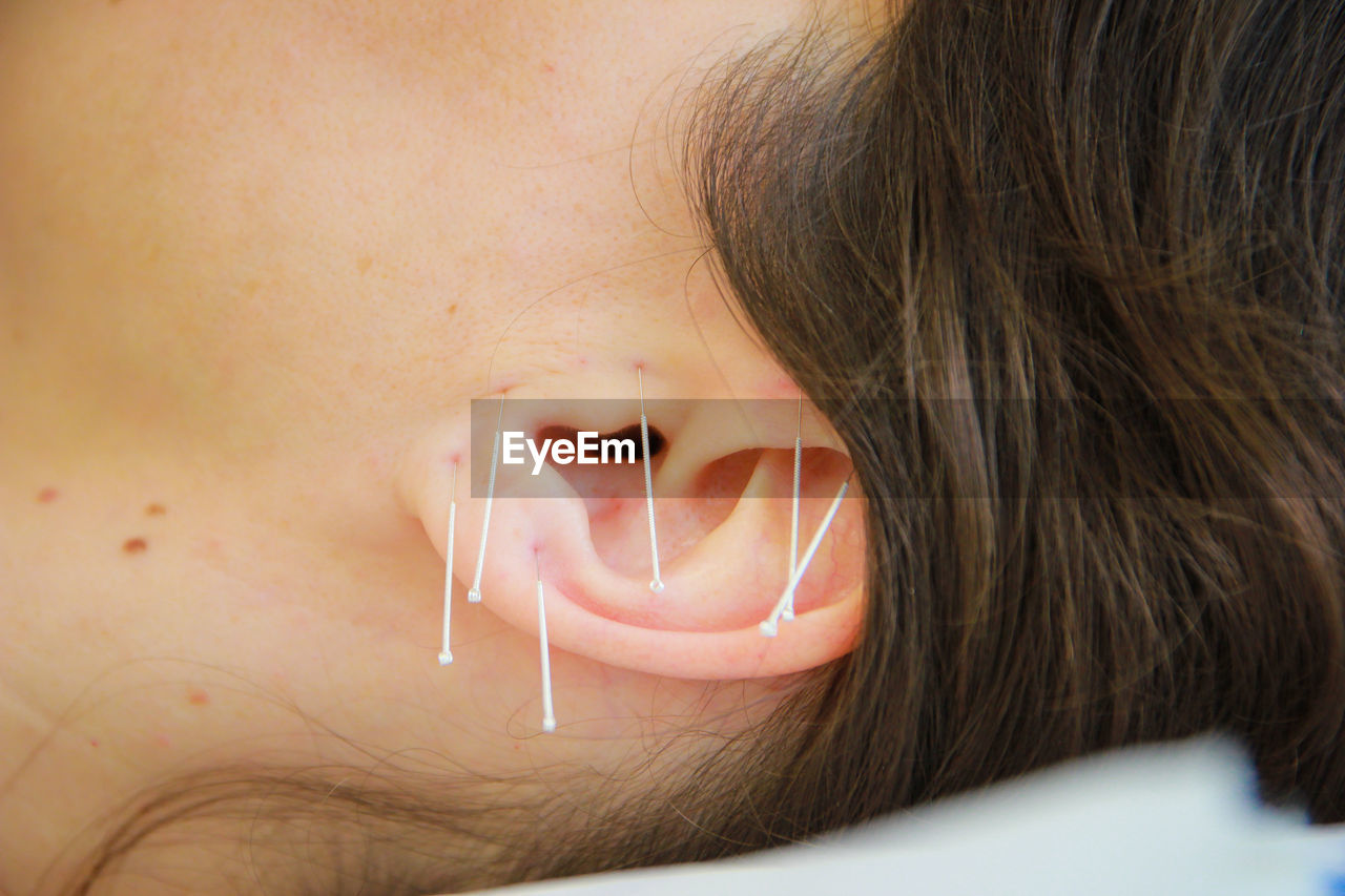 Close-up of woman with acupuncture needles on ear