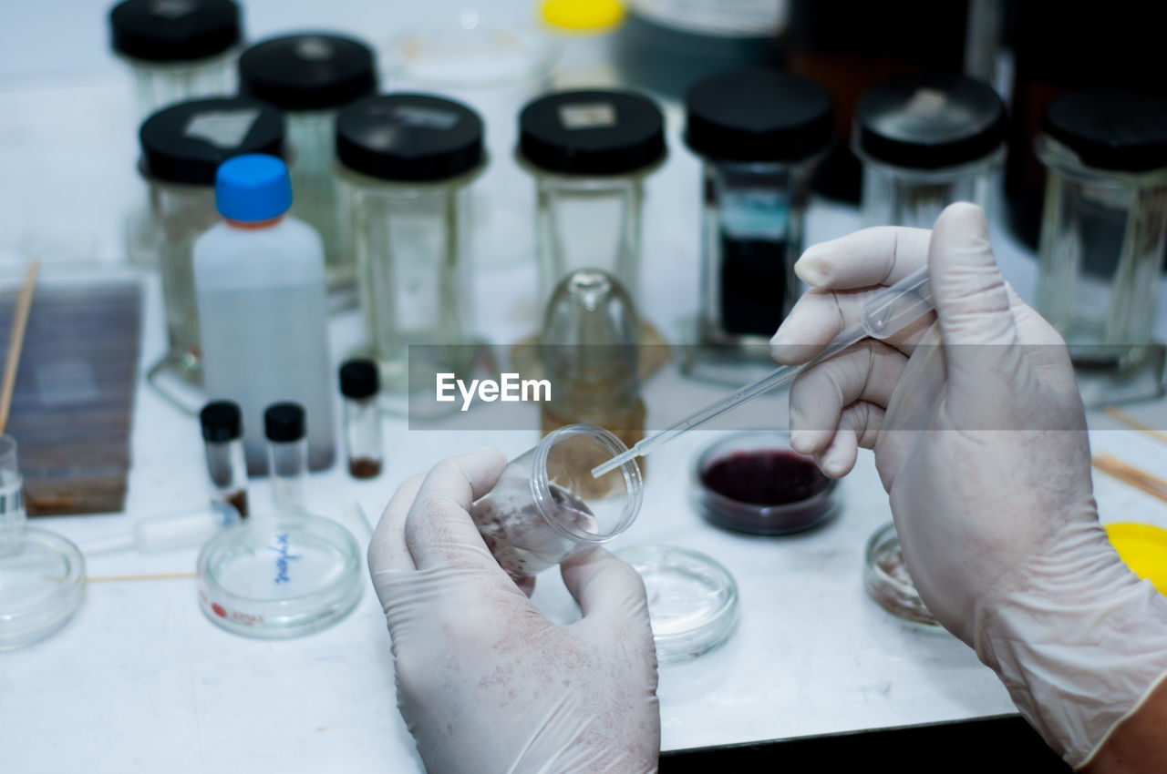 Cropped hand of scientist holding medical sample in container at laboratory