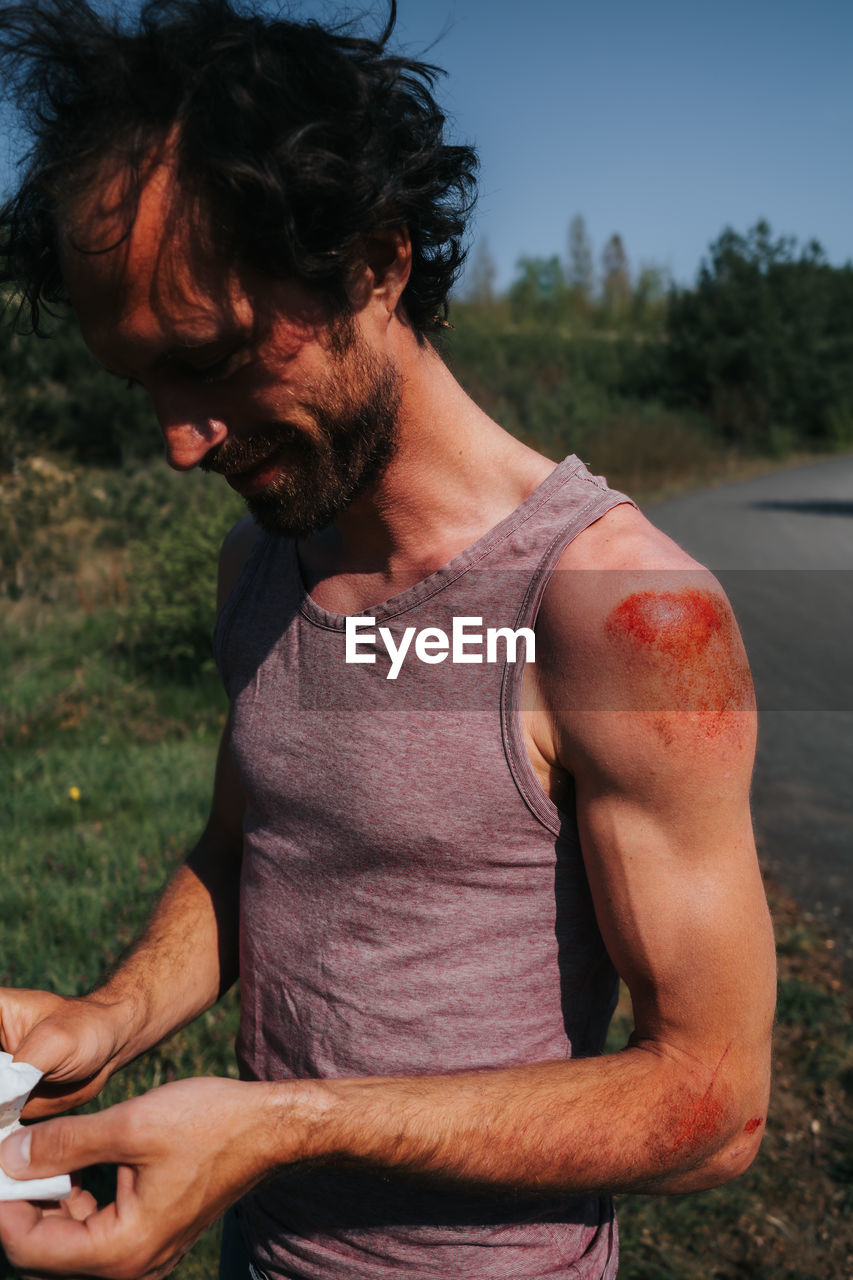 Man with abrasion on shoulder and arm after skateboard accident