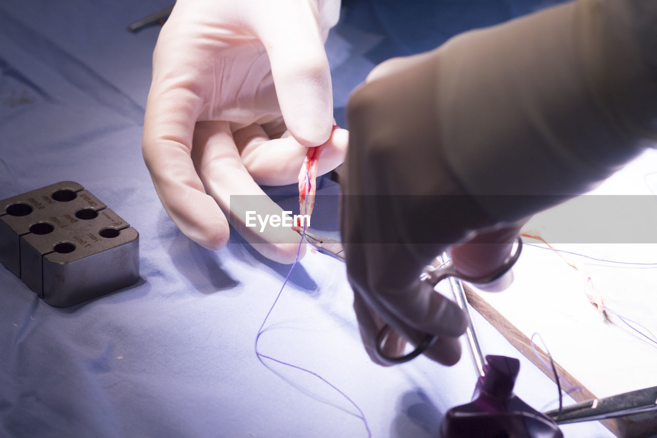 Cropped hands of doctor cutting stitches over table