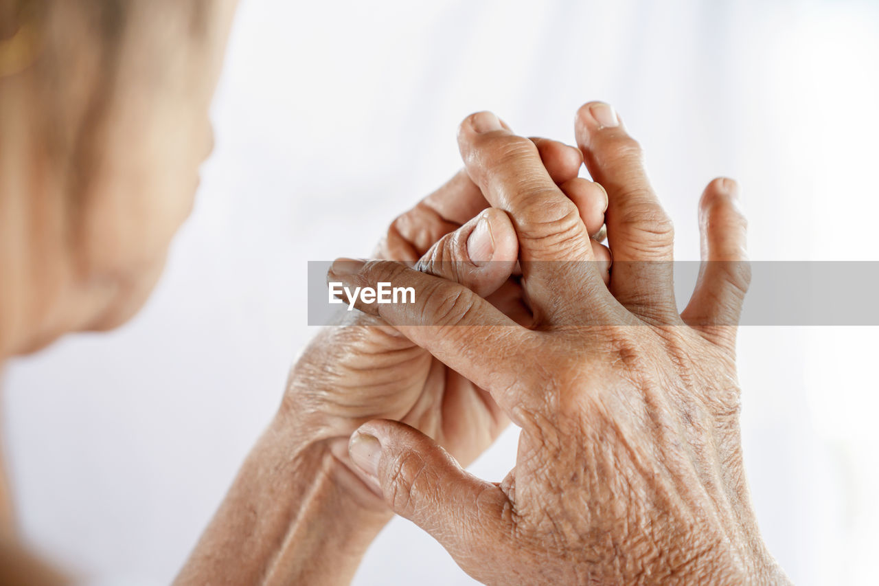 Close-up of senior woman with wrinkled fractured hands