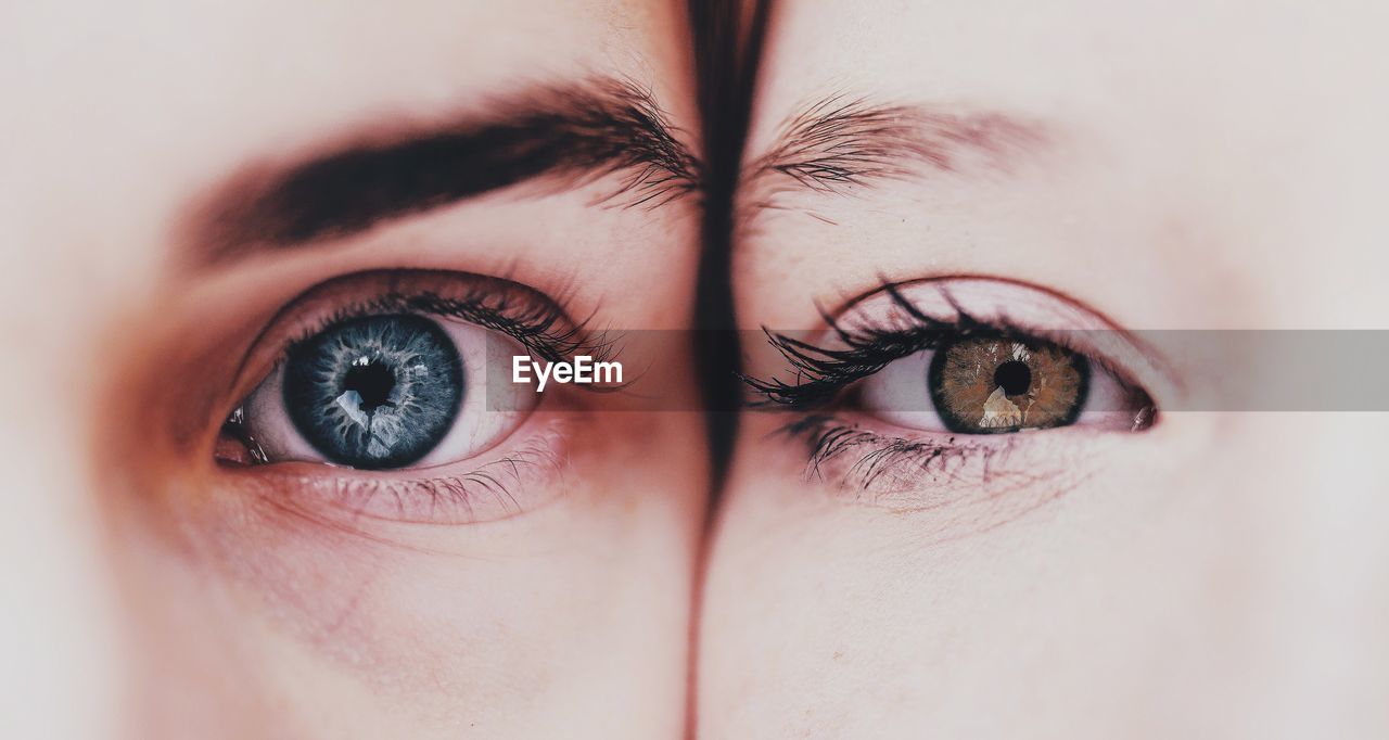 Close-up view of eyeball