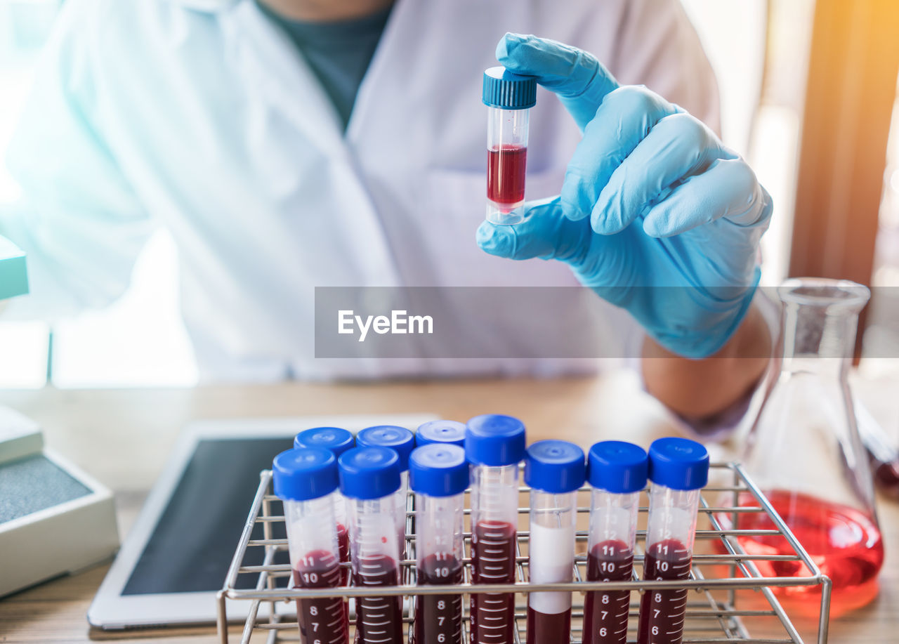 Midsection of scientist holding blood bottles in laboratory