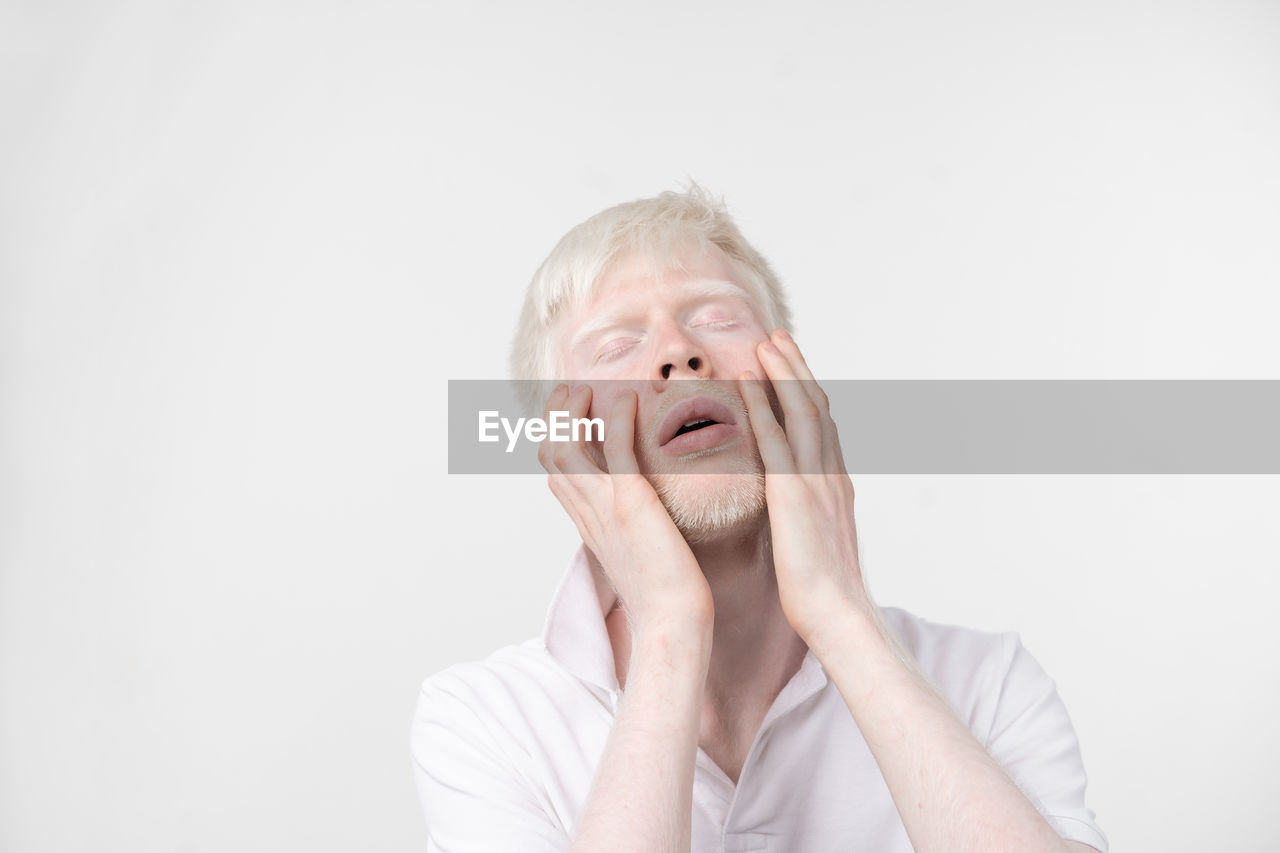 Close-up of man with albino with hands on cheeks against white background