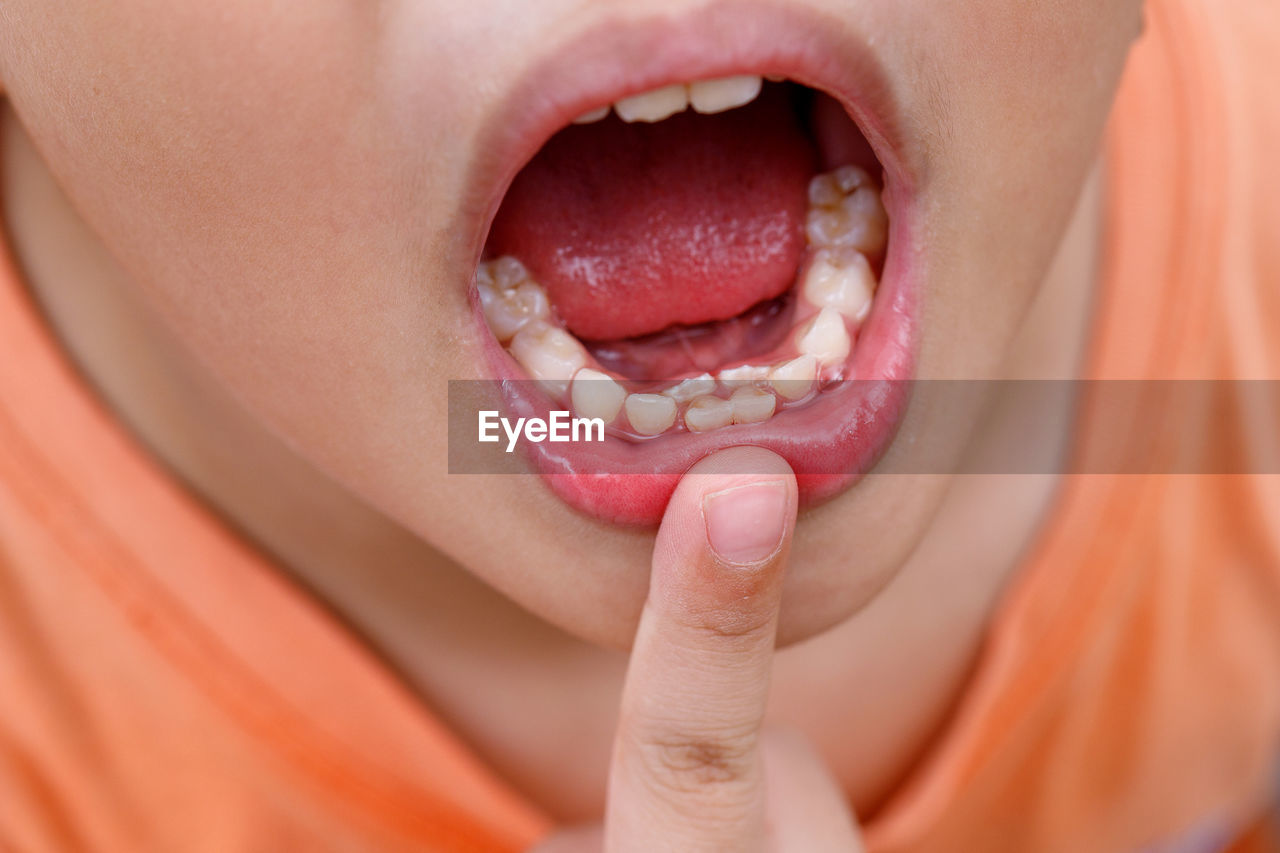 Close-up of boy with mouth open showing teeth