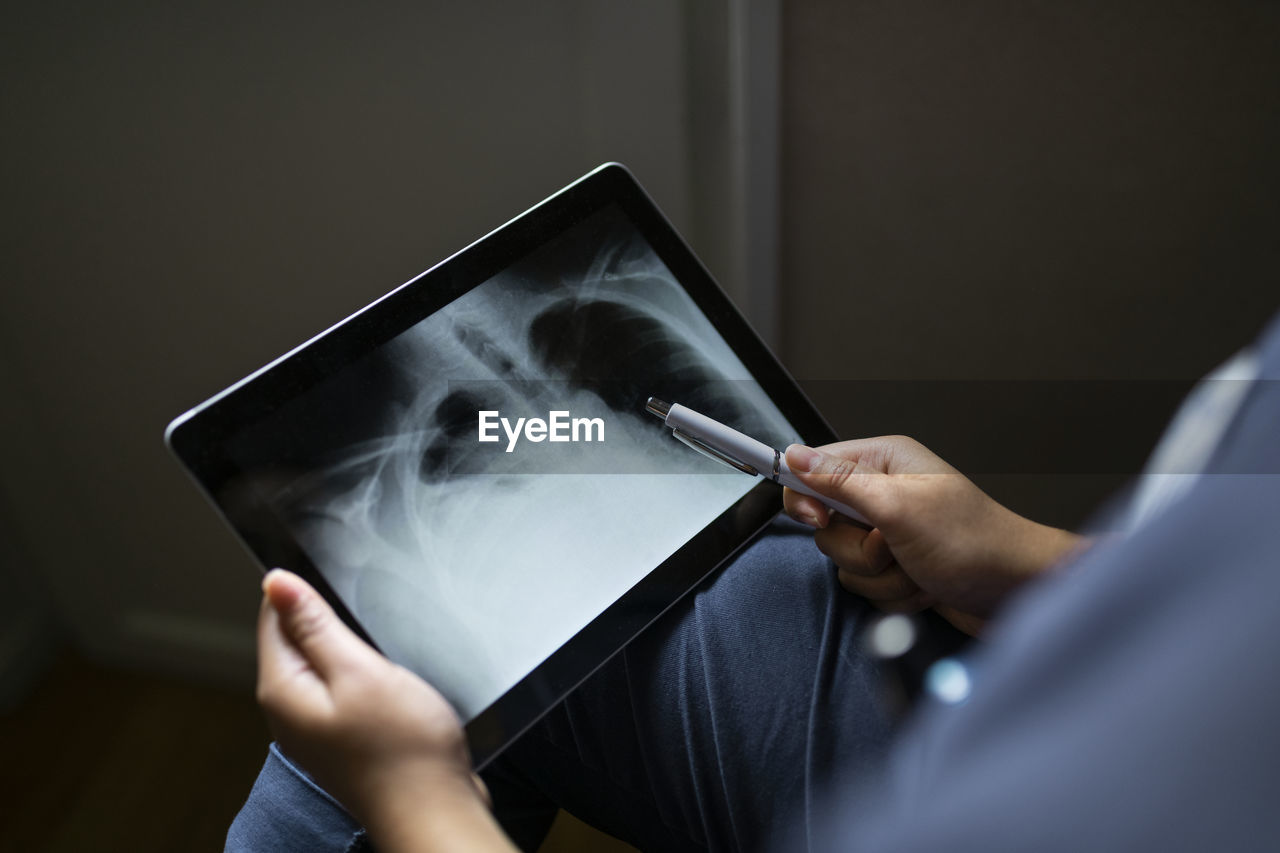 Hands holding digital tablet showing x-ray