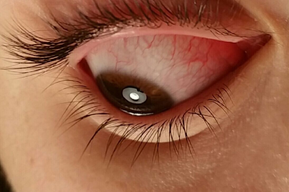 EXTREME CLOSE-UP OF HUMAN EYE