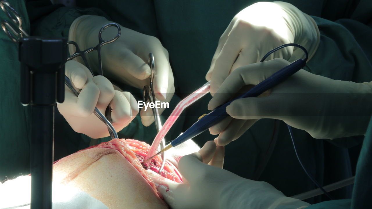 Midsection of doctor operating patient during surgery