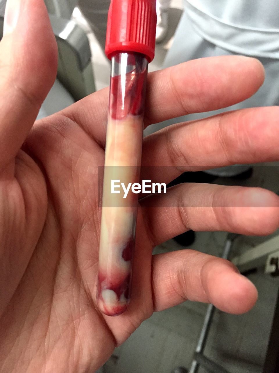 Sample of blood 