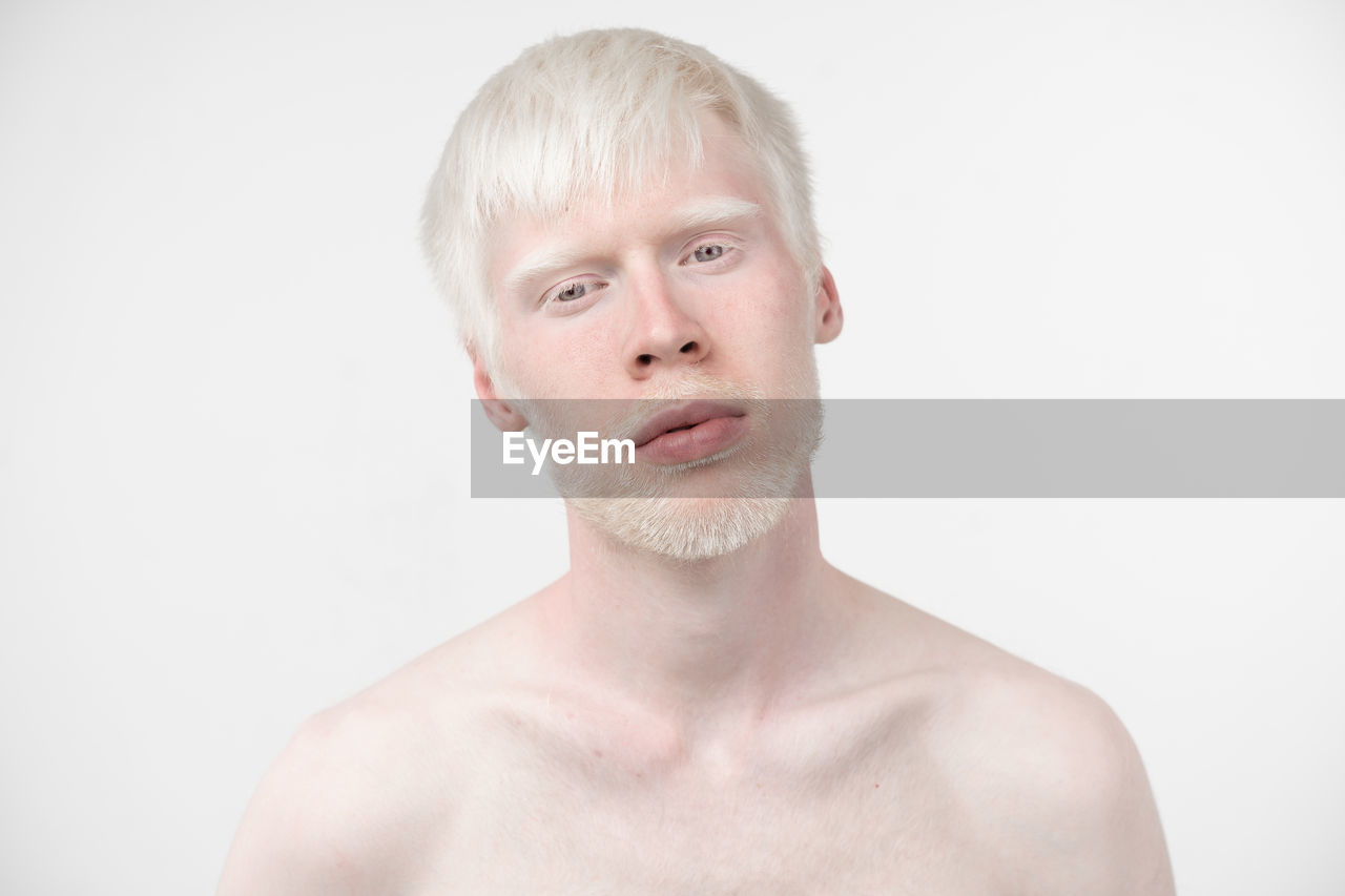 Portrait of shirtless young man with albino against white background