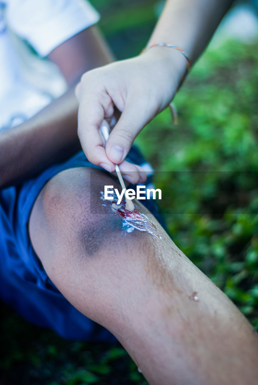 Cropped hand of doctor applying medicine on wound