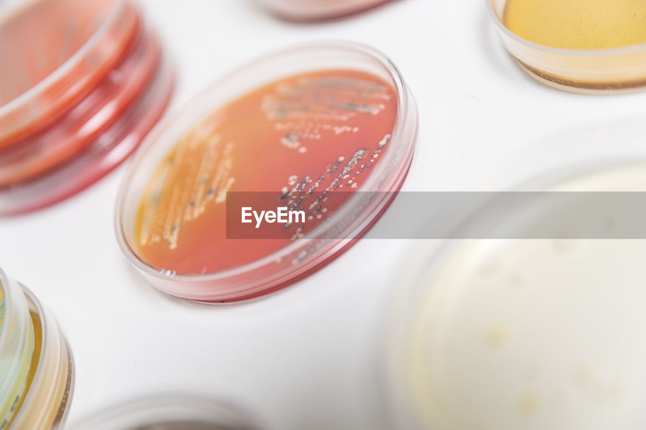 Laboratory analysis. closeup on a plate with bacteria cultivation.