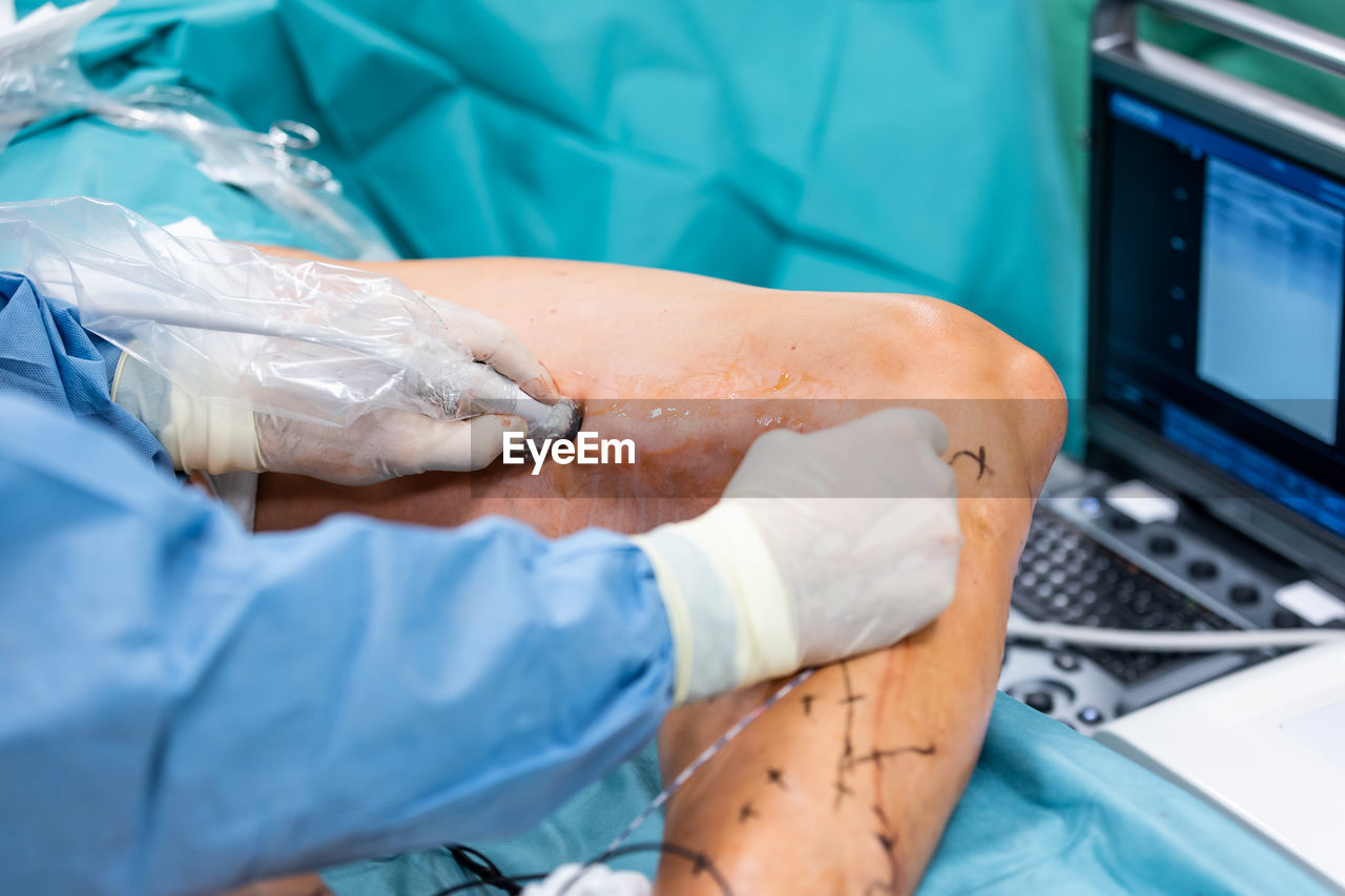 midsection of doctor examining patient at hospital