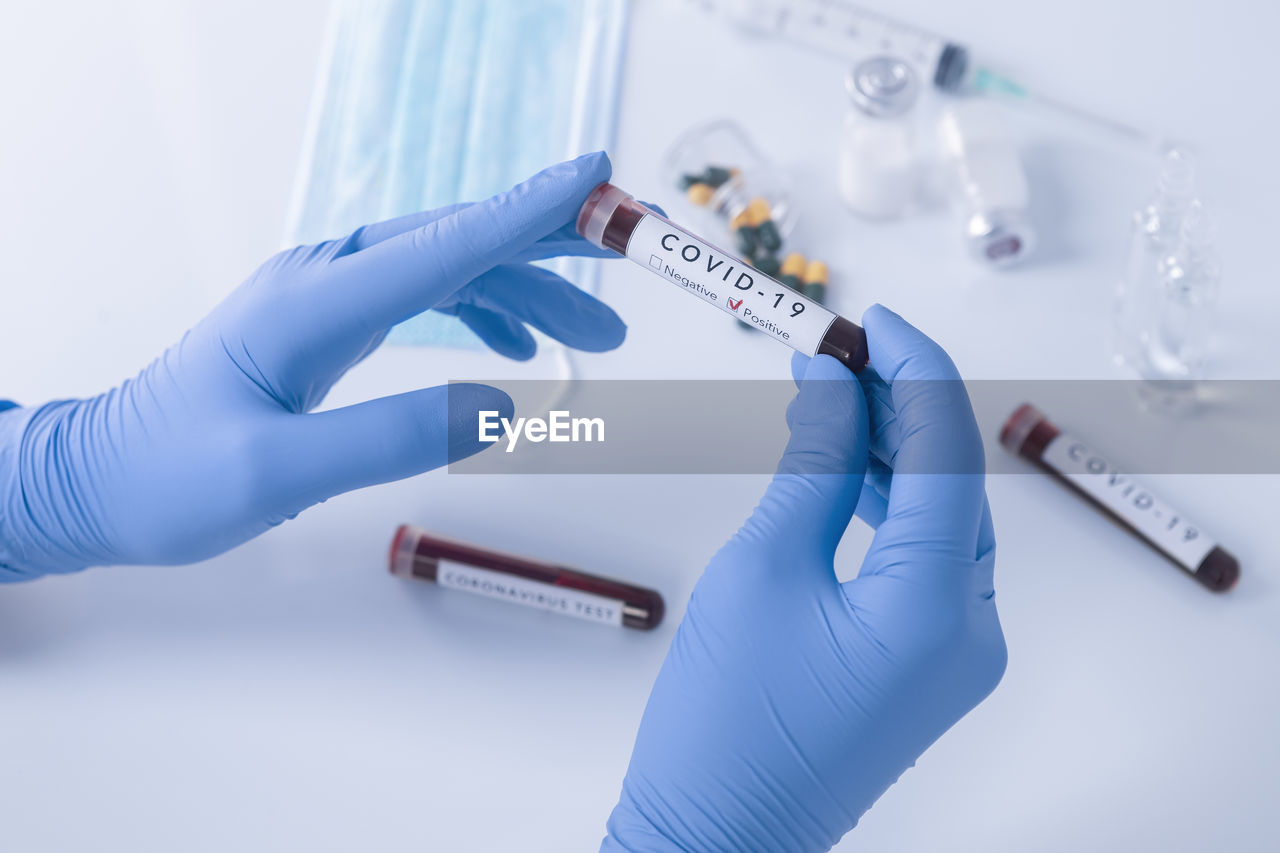 Analyst hand with protective gloves holding covid 19 coronavirus test blood. focus on test blood.