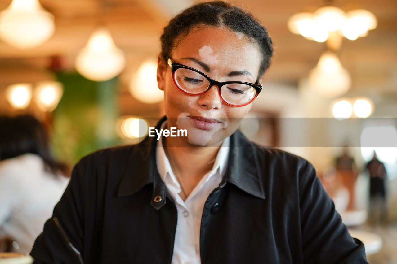 Close-up of young woman with vitiligo sitting in restaurant