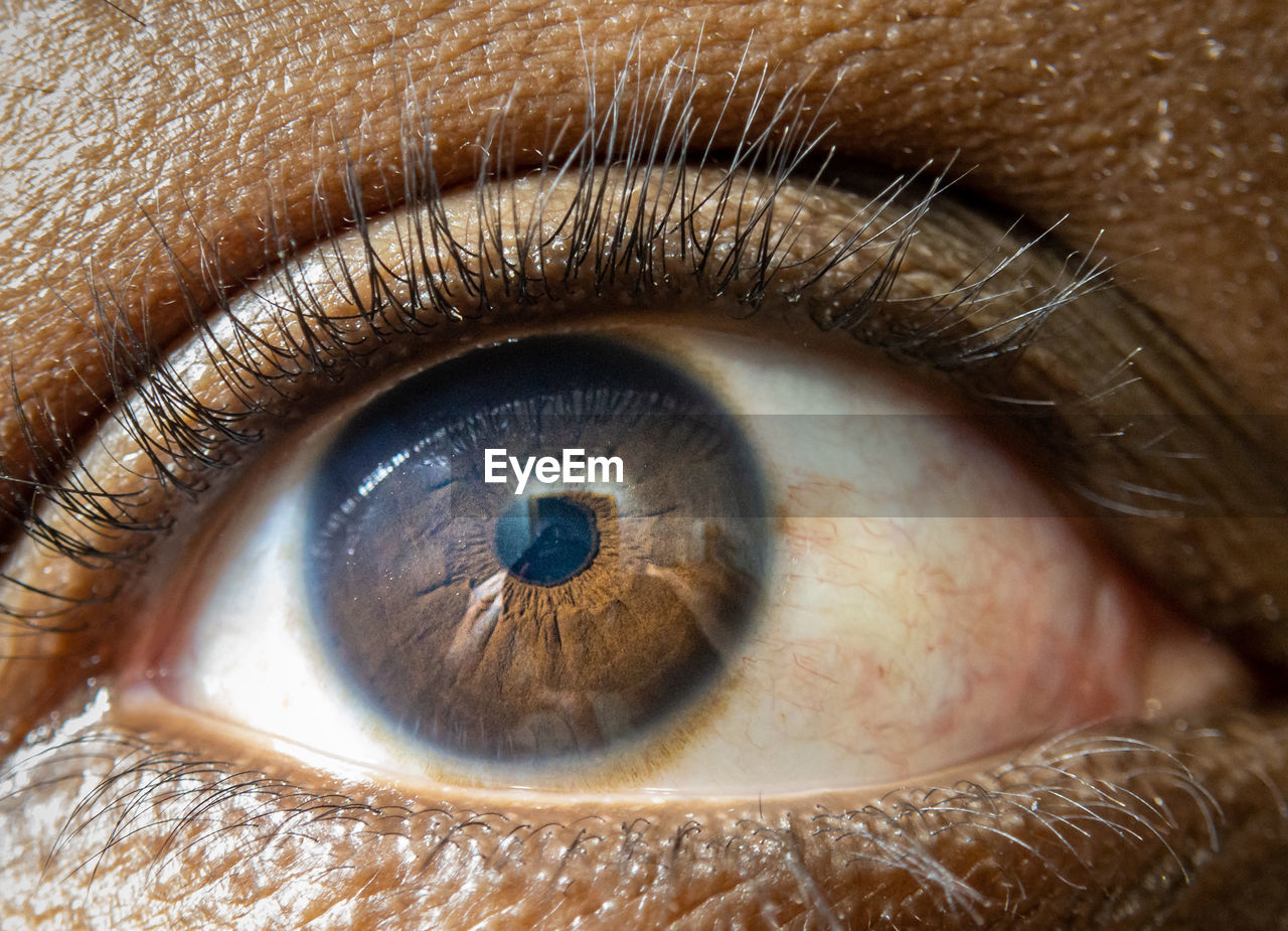 Close up of african american mans dark brown eyes for use in ophthalmology optometry imagery