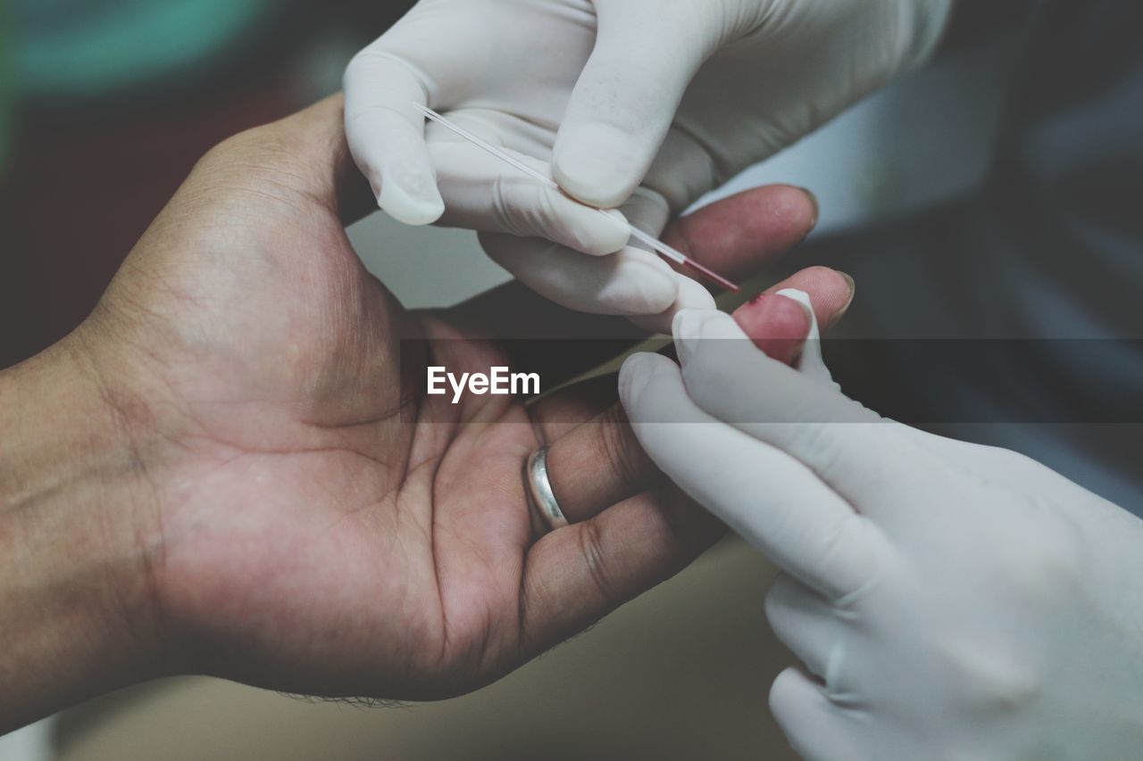 High angle view of doctor doing blood text on patient