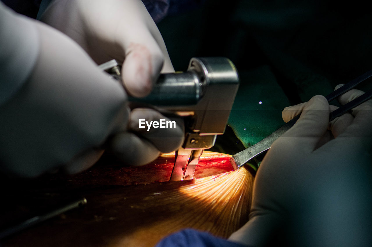 Cropped hands of doctor performing surgery on patient in hospital