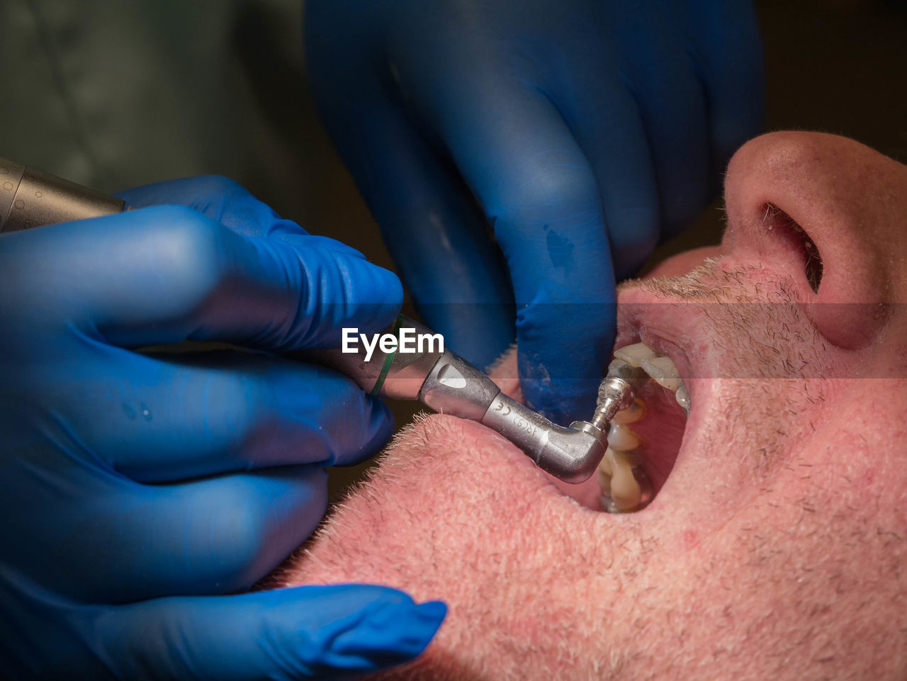 Cropped hands of dentist using equipment on patient