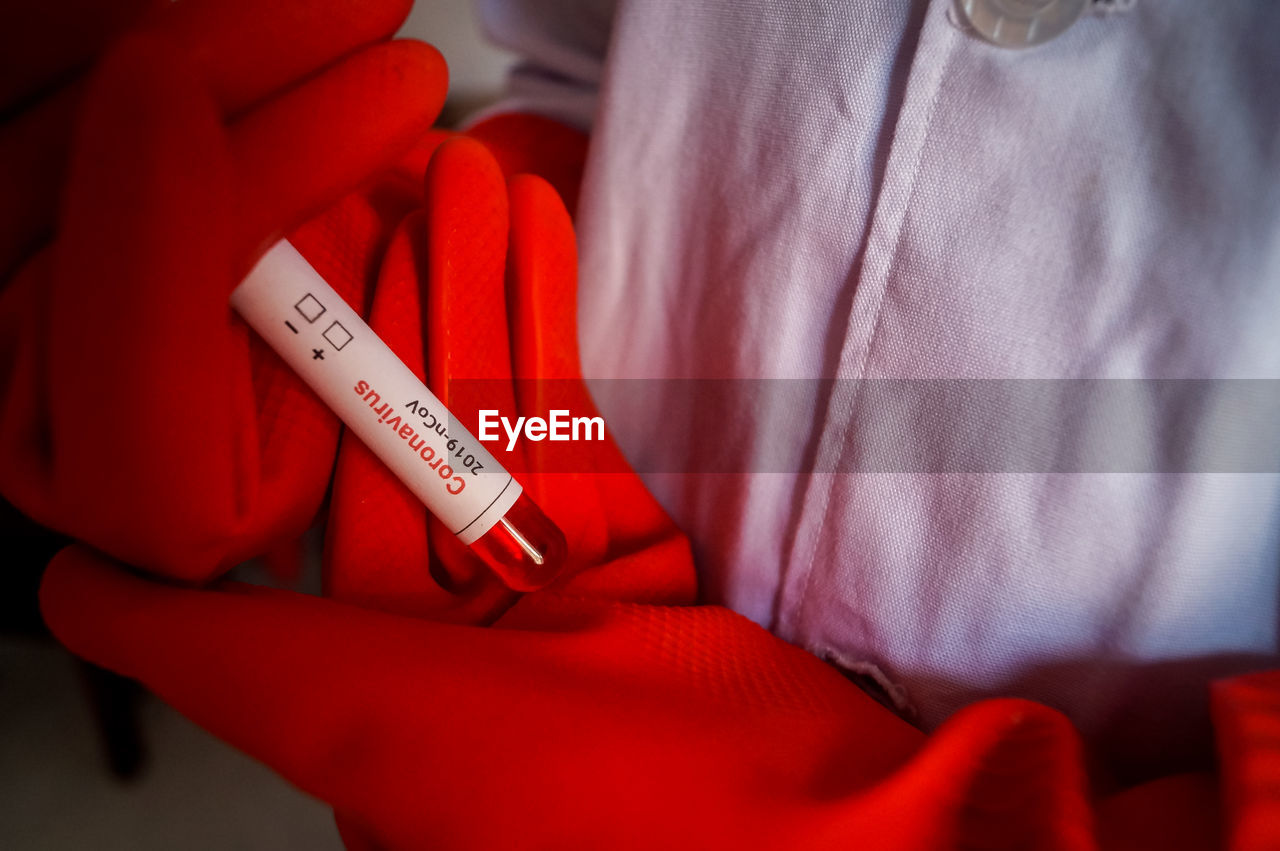 Close-up of hand holding blood test sample