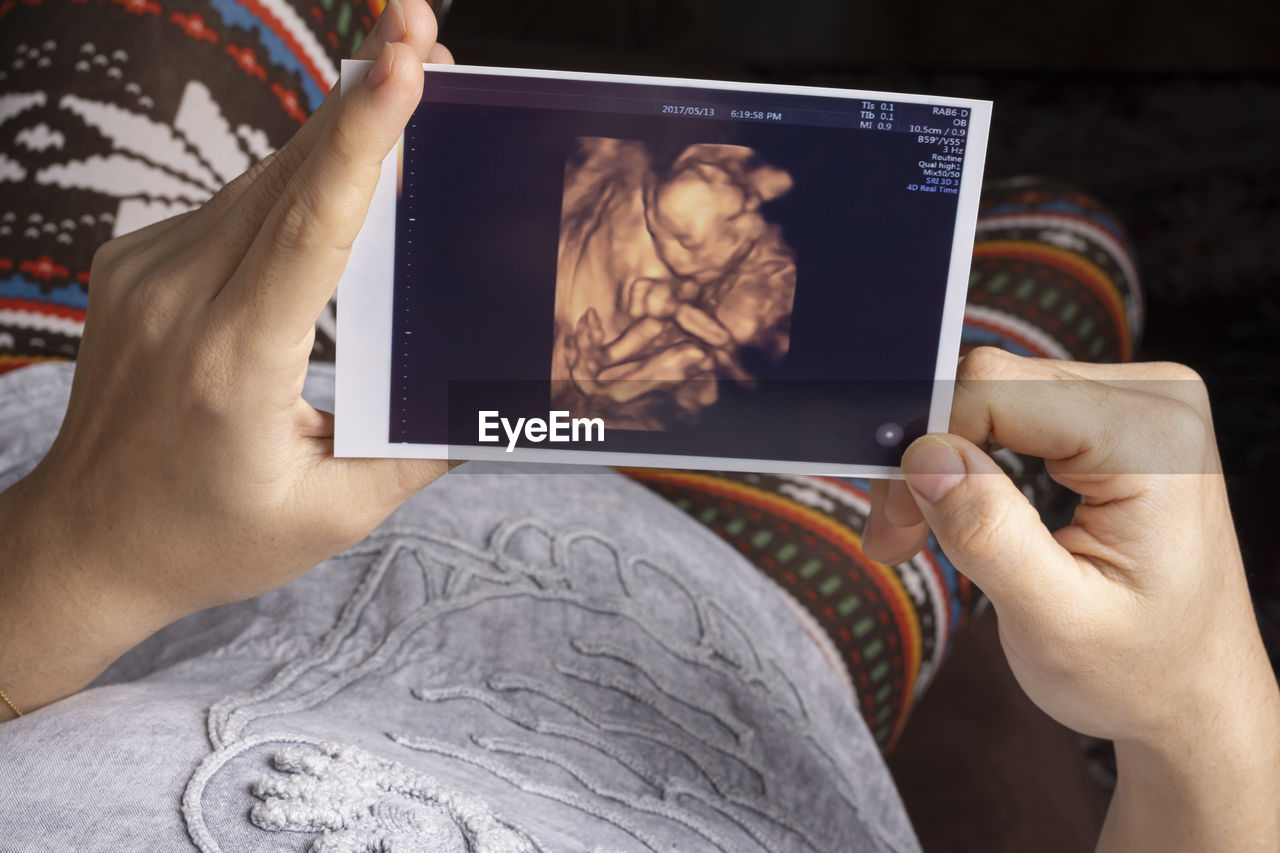 Young mother holding an unborn baby sonography 4d image in hands resting on sofa