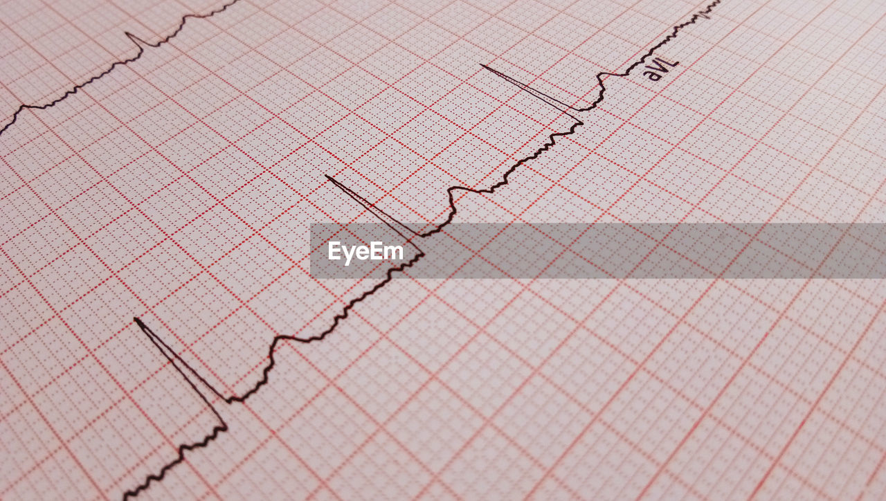 Full frame shot of line graph paper